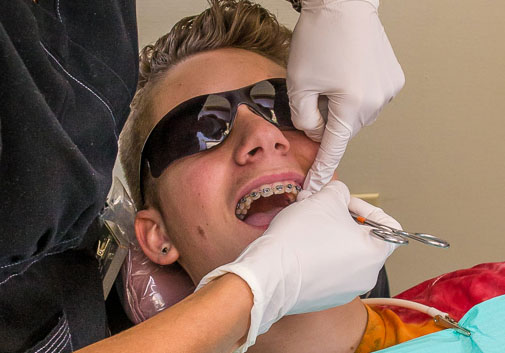 Performing preventative dentistry