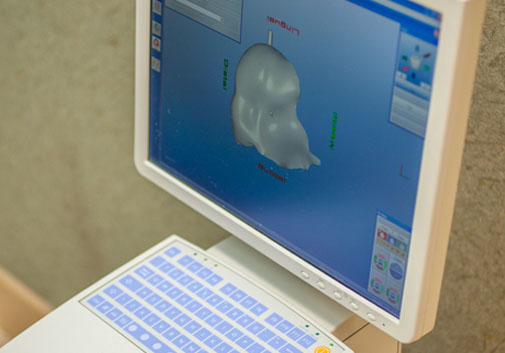 Designing restoration using CEREC machine